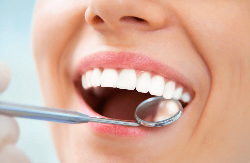 Beautiful White Teeth Beautiful White Teeth