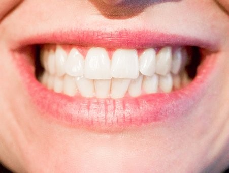 naturally stopping receding gums
