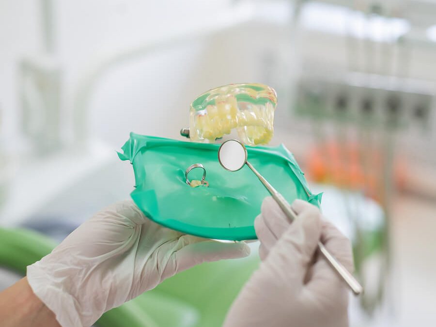 Dental Dams for Dentists | All You Need to Know