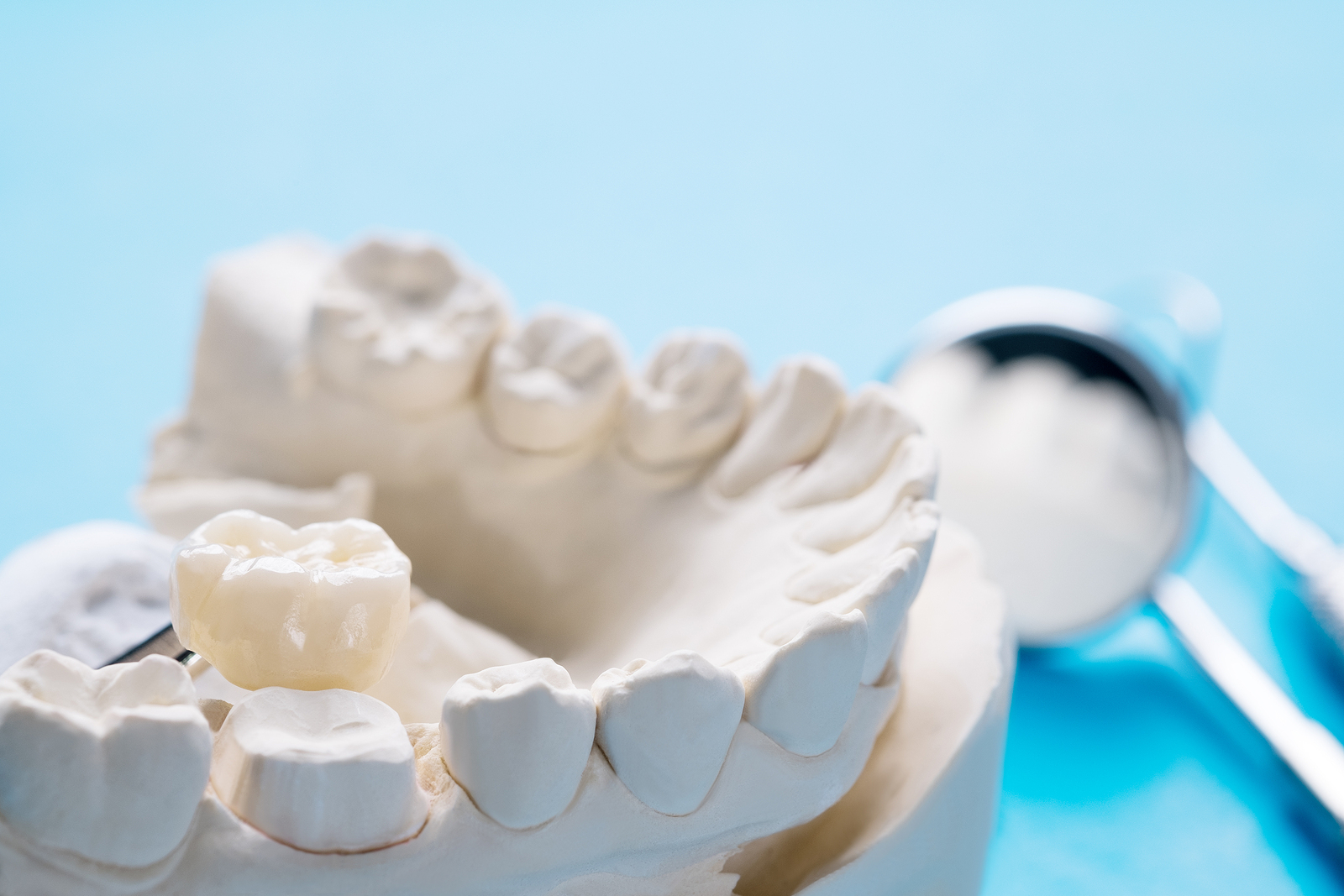 Porcelain Crowns Porcelain Bonded Crowns Treatment Care Advice