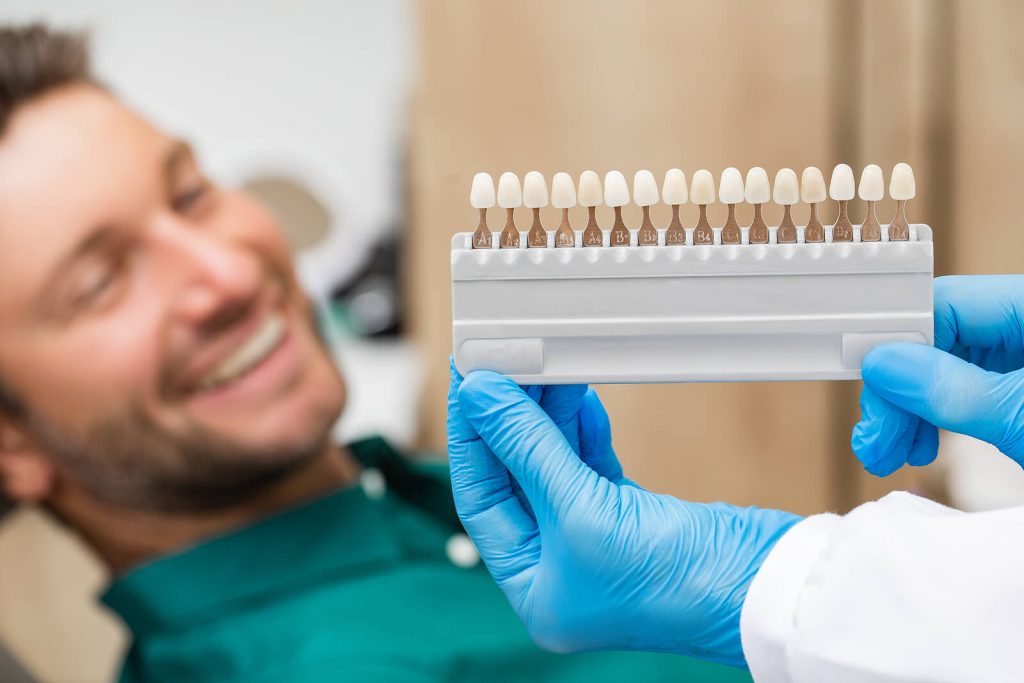 Palette tooth colour sample to determine shade over patient's teeth