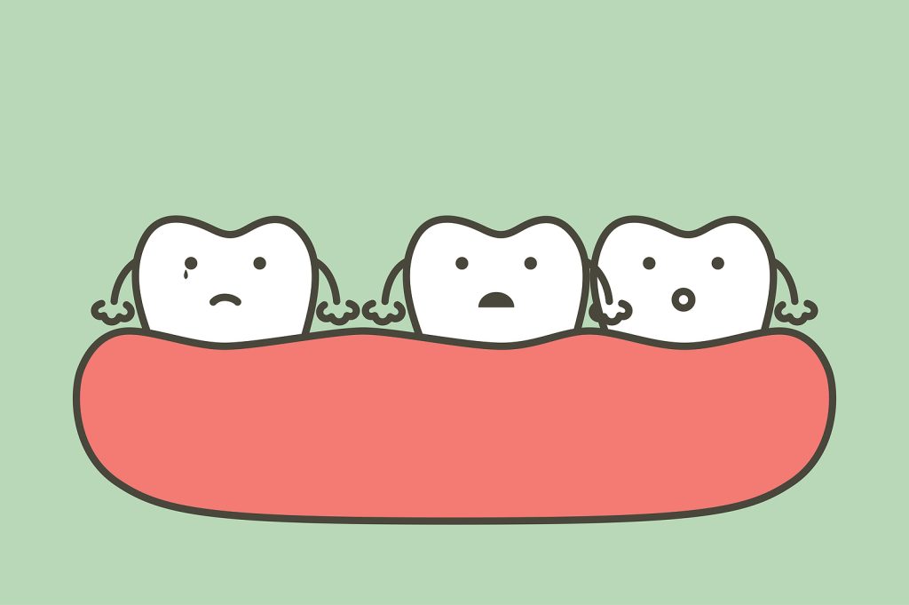 spacing teeth (diastema), dental problem