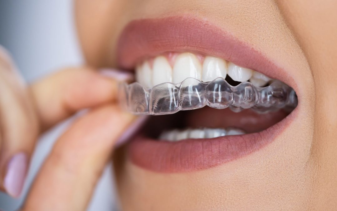 Clear Aligner Dental Night Guard For Teeth